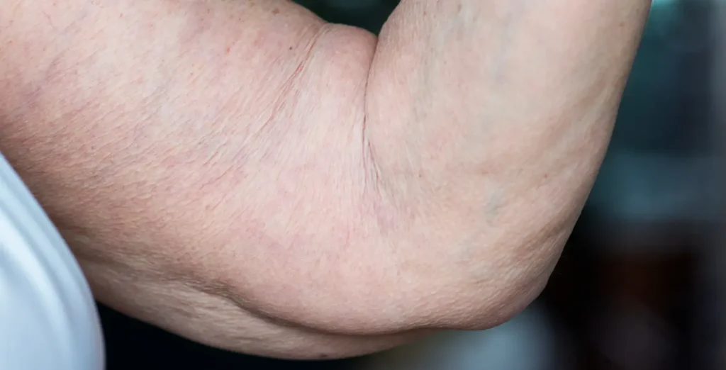 The Hidden Damage: How Diabetes Attacks Your Cells