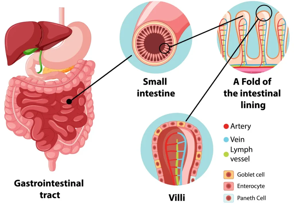 Medical diagram of the small intestine lining and villi, where nutrient absorption occurs within the digestive tract.