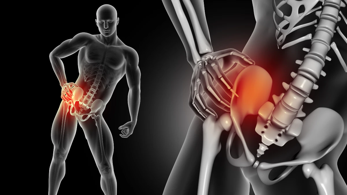 Anatomical diagram of the hip joint labeling the hip flexors, glutes, and piriformis muscle to identify the biological causes of gluteal tendinopathy and stiffness.