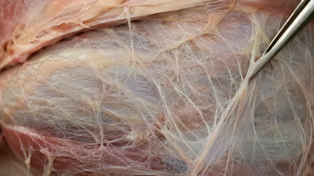 Medical illustration of human fascia layers showing the fibrous network that supports metabolic heat production and tissue gliding.